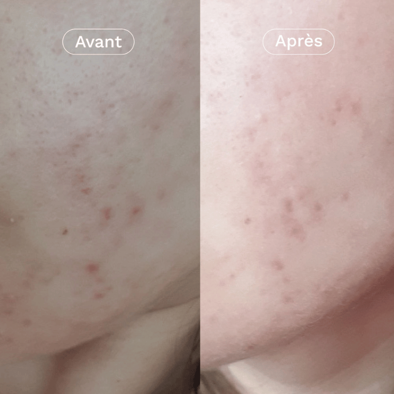 Ma Jolie Peau - Crème Visage Hydratante et Rééquilibrante