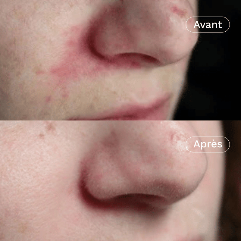 Ma Jolie Peau - Crème Visage Hydratante et Rééquilibrante
